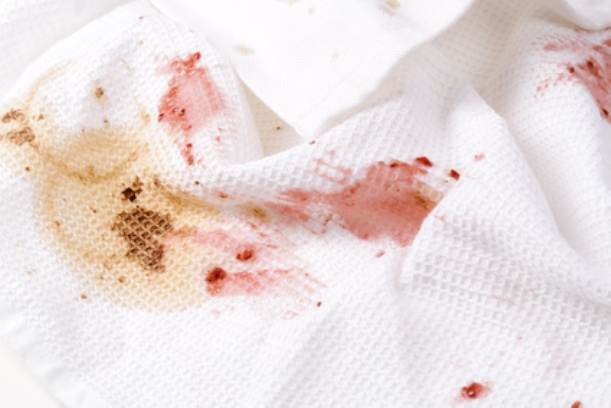 5 Household Remedies to Remove Stubborn Holiday Stains :: YummyMummyClub.ca