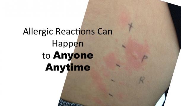 Allergic reactions can happen to anyone, anytime.