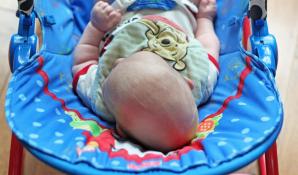 Craniosynostosis is Why You Should Pay Attention to Your Baby's Head Shape