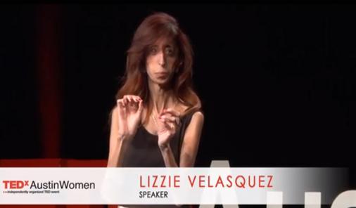 the lizzie project