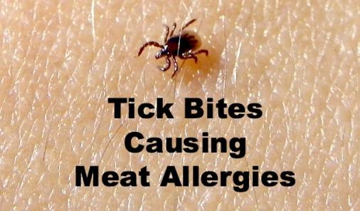 Tick bites are causing meat allergies in the U.S.